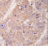 UVRAG Antibody (aa366-398)