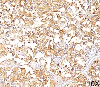 HMB45 Antibody (clone HMB45, Ready-to-Use)