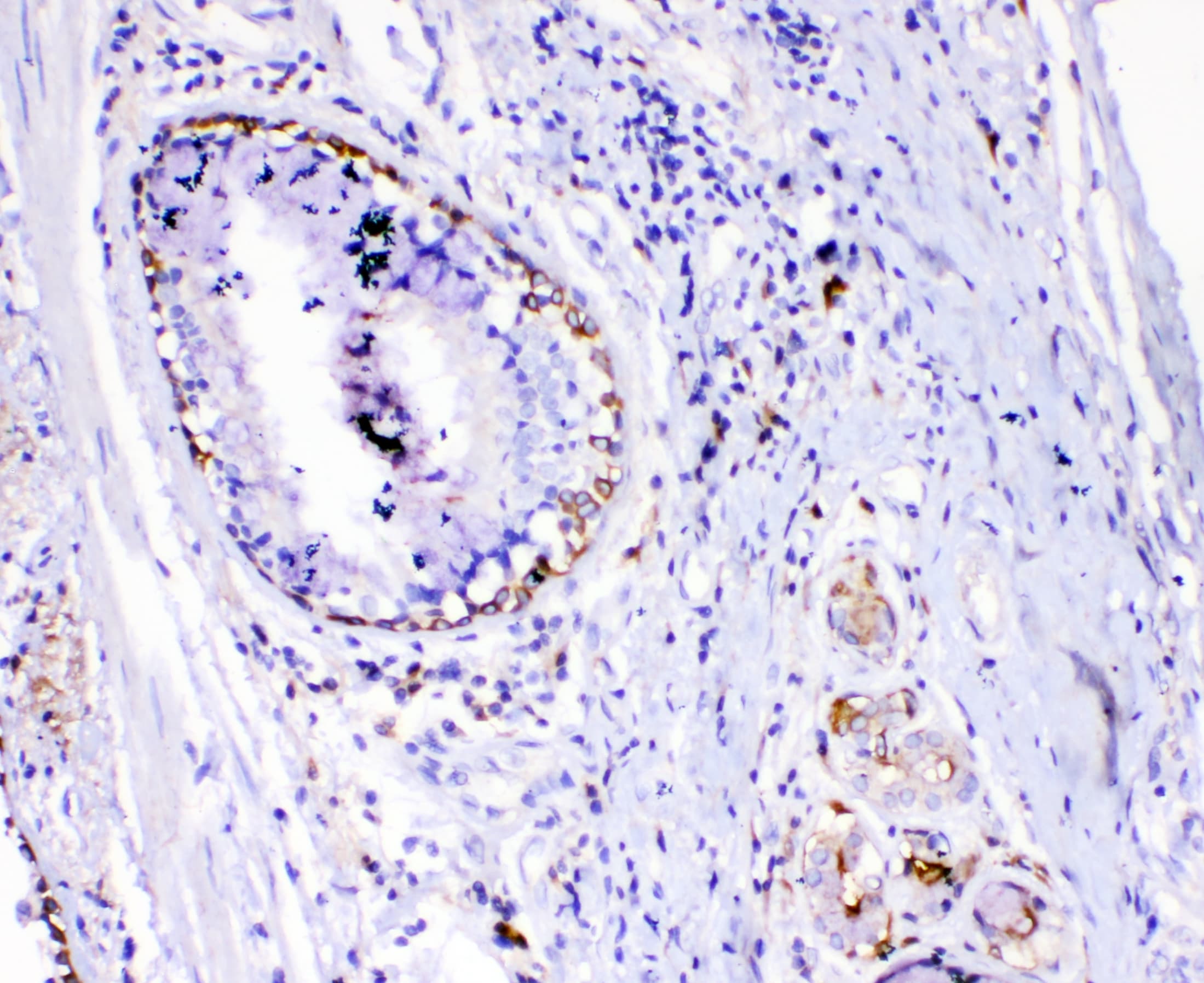 Polyclonal Rabbit anti-Human TNFSF15 / TL1A / VEGI Antibody (WB)