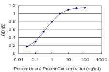 IHC-plus™ Monoclonal Mouse anti-Human MDM2 Antibody (clone 1A7, IHC, WB)
