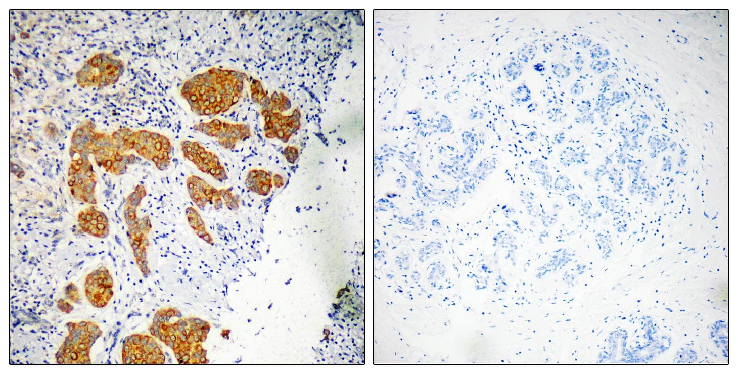 CKLFSF4 / CMTM4 Antibody