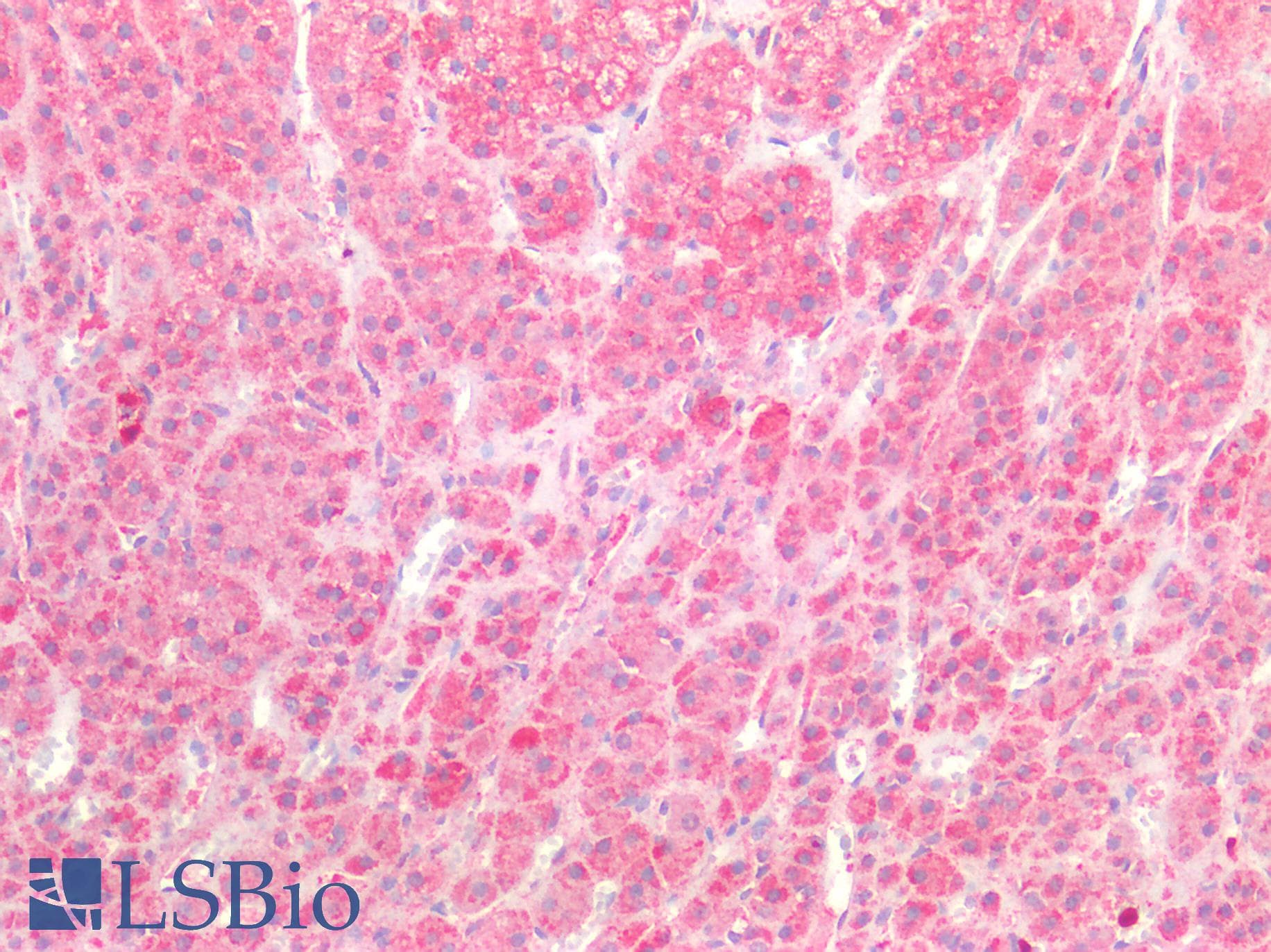 PathPlus™ Polyclonal Rabbit anti-Human SLC16A2 / MCT8 Antibody (Internal, IHC, WB)