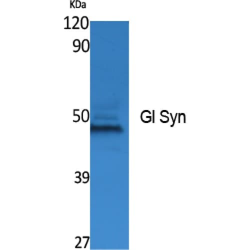 GLUL / Glutamine Synthetase Antibody (Internal)