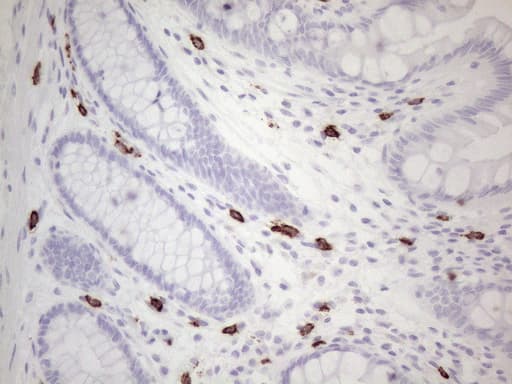 c-Kit / CD117 Antibody (aa27-308, clone OTI2B12, Carrier-free)