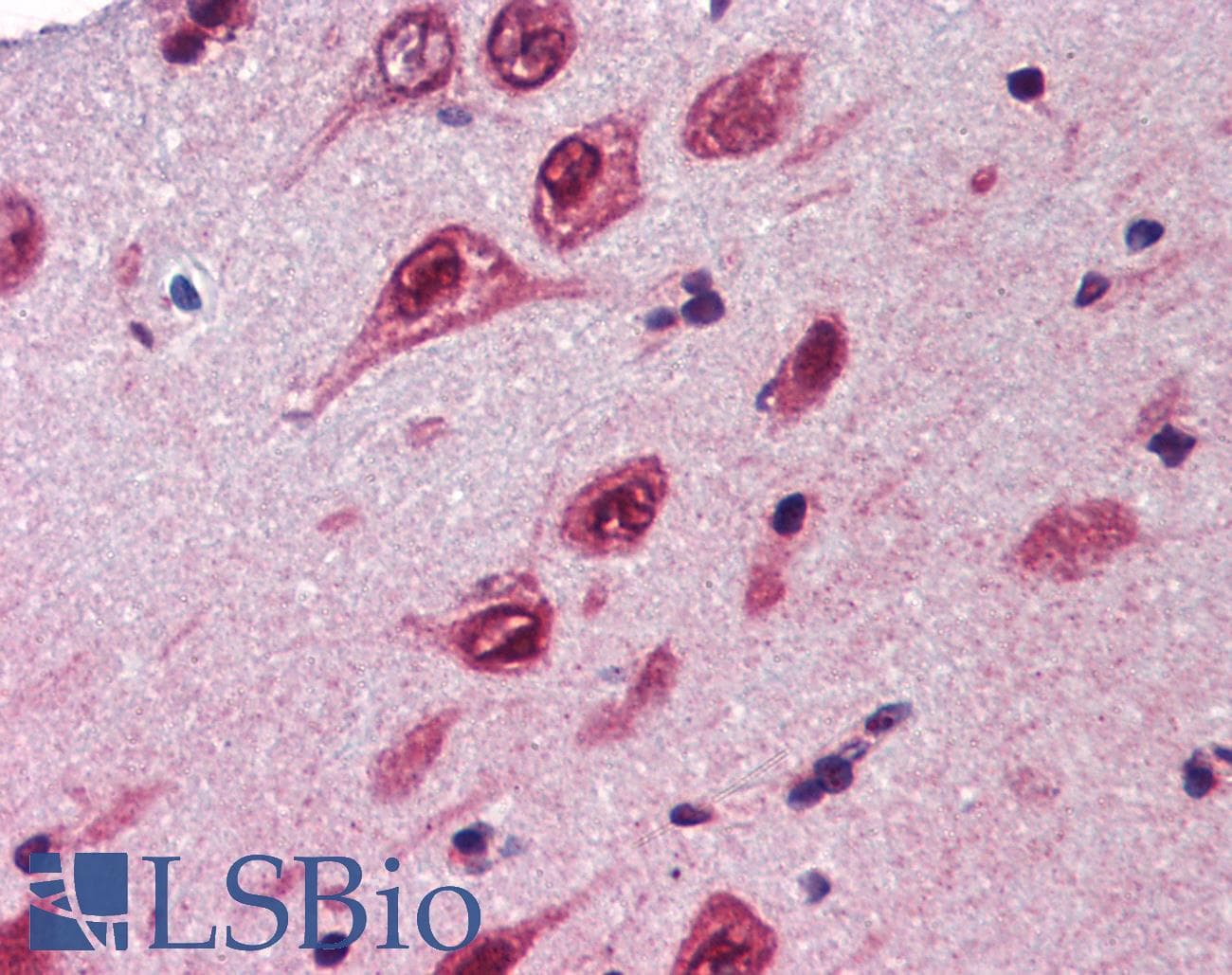 UBQLN1 / Ubiquilin Antibody (aa290-339)