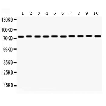 HSPA9 / Mortalin / GRP75 Antibody (aa646-679)