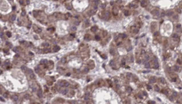 SSTR5 Antibody