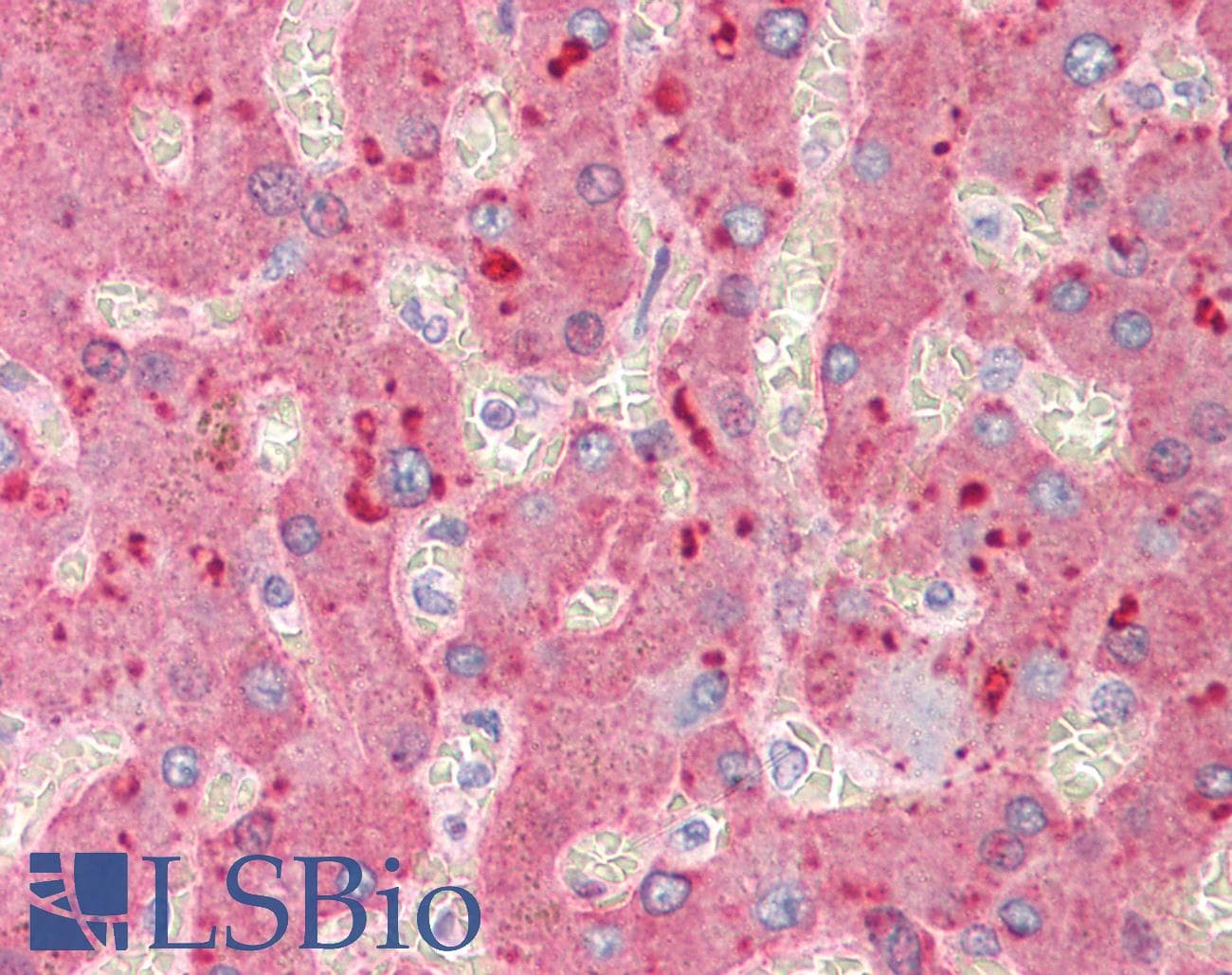 IHC-plus™ Polyclonal Goat anti-Human A2M / Alpha-2-Macroglobulin Antibody (IHC, WB)