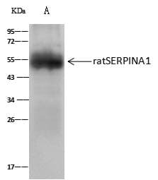 Polyclonal Rabbit anti-Rat SERPINA1 / Alpha 1 Antitrypsin Antibody (Preservative Free, WB)