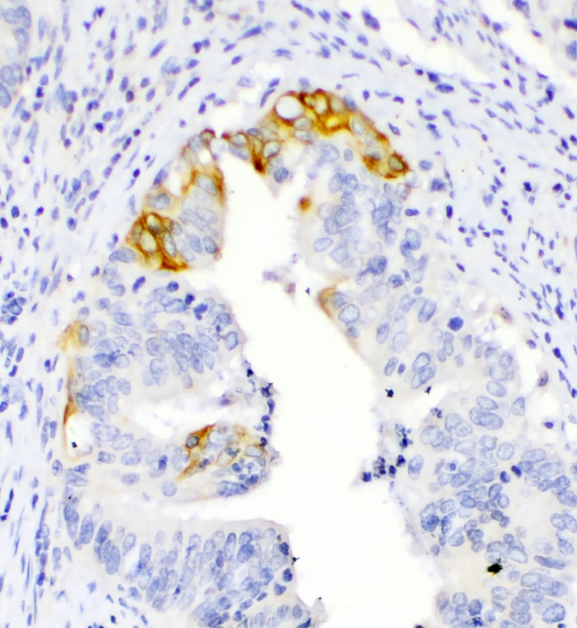 Polyclonal Rabbit anti-Human TNFSF15 / TL1A / VEGI Antibody (WB)