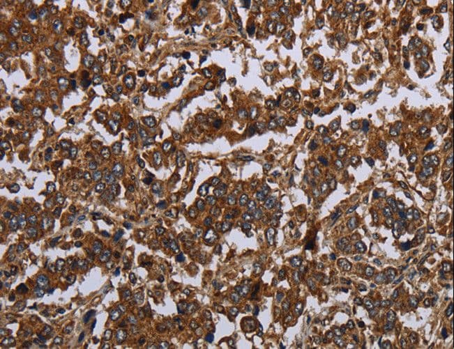 HOMER2 / Homer 2 Antibody