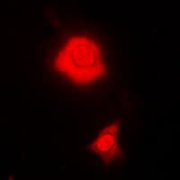 Polyclonal Rabbit anti-Human RBFOX3 / NEUN Antibody (IHC, IF, WB)
