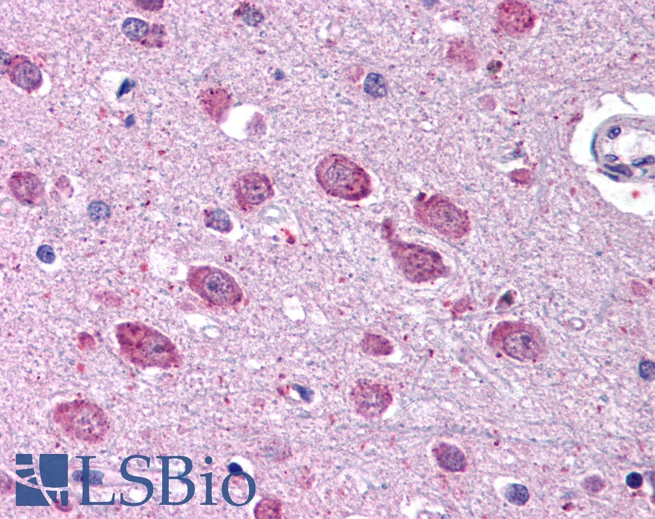 IHC-plus™ KIAA1811 / BRSK1 Antibody