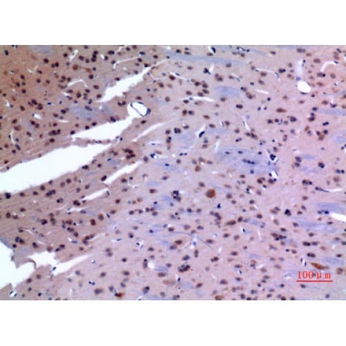 HSP90 / Heat Shock Protein 90 Antibody