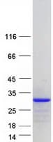 Human CT45A6 Protein (Recombinant Myc-DDK (Flag))