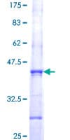 Human EXOSC9 / p5 Protein (Recombinant GST, N-terminus)