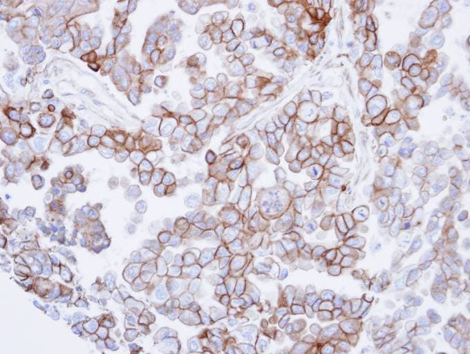 Polyclonal Rabbit anti-Human SNTB2 Antibody (aa174-540, IHC, WB)