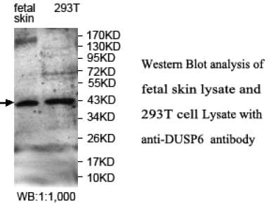 IHC-plus™ DUSP6 / MKP3 Antibody (aa14-201)