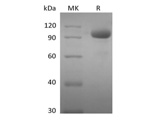 Human EPHA8 / EPH Receptor A8 Protein (Recombinant Fc, C-terminus)