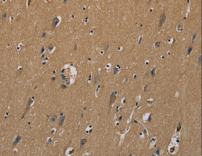 PLIN3 / M6PRBP1 / TIP47 Antibody