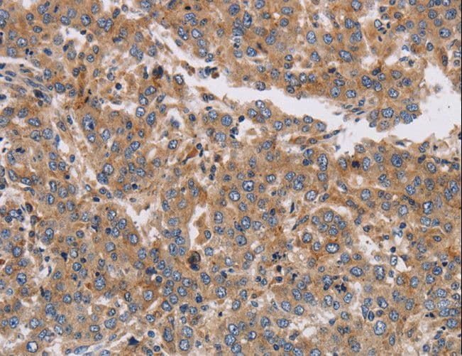 Polyclonal Rabbit anti-Human K13 / KCNG Antibody (IHC)
