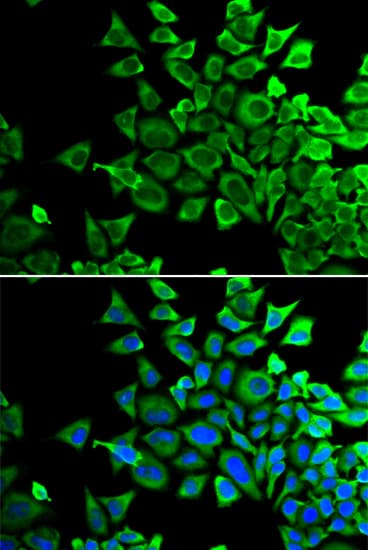BAD Antibody