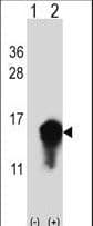 CSTA / Cystatin A Antibody (aa69-98)