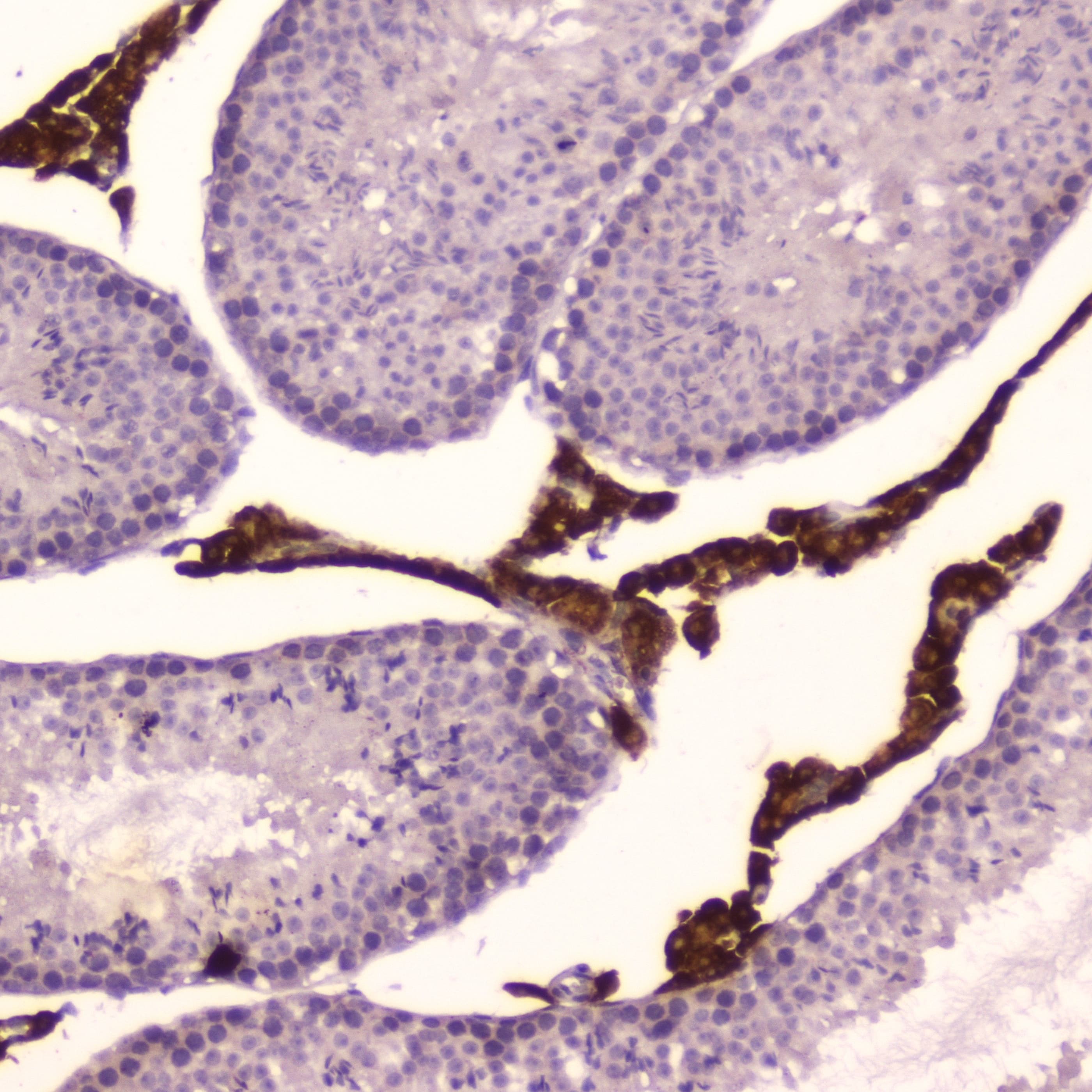 CYP17 / CYP17A1 Antibody