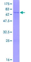 Human ASAH1 / Acid Ceramidase Protein (Recombinant GST)