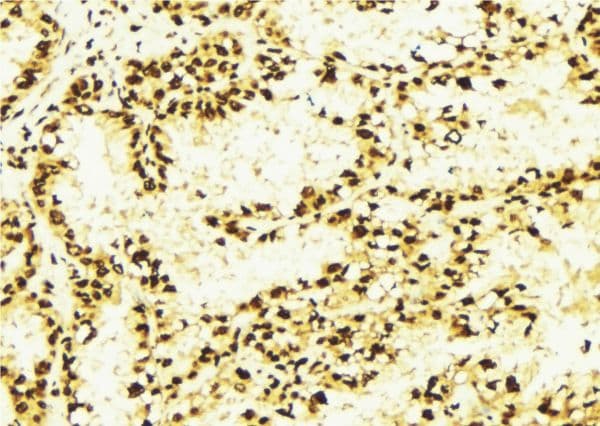 HDAC2 Antibody
