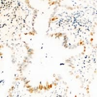 USP36 Antibody (Internal)