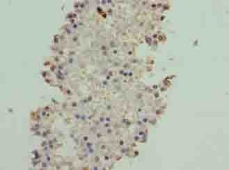 ATXN7L1 Antibody