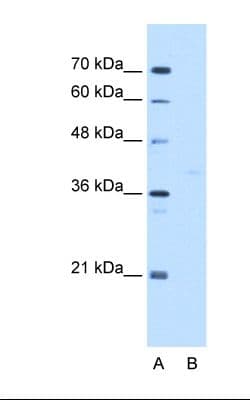 GMPPB Antibody (C-Terminus)