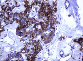 ARMC1 Antibody (clone OTI2E5)