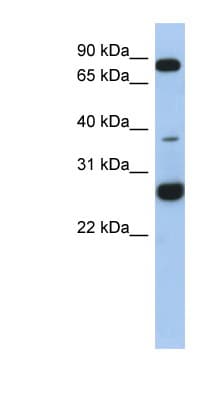 Polyclonal Rabbit anti-Human C1orf110 Antibody (aa35-84, WB)