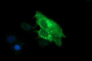 SYP / Synaptophysin Antibody (clone OTI2E7)