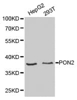 Polyclonal Rabbit anti-Human PON2 Antibody (IHC, WB)