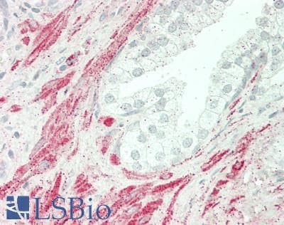 IHC-plus™ CAV3 / Caveolin 3 Antibody (aa1-151)