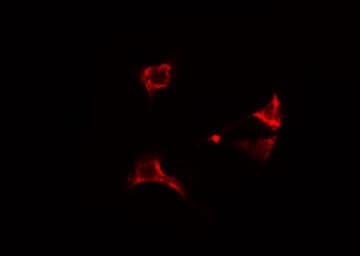 CLIP3 Antibody