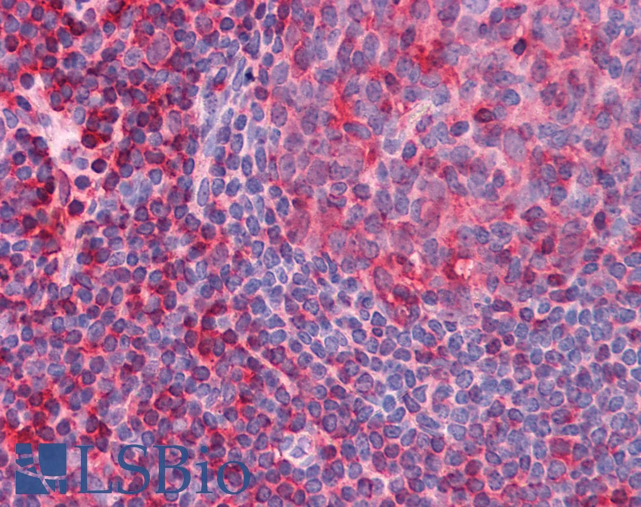 IHC-plus™ LDHB / Lactate Dehydrogenase B Antibody (clone 2H6)
