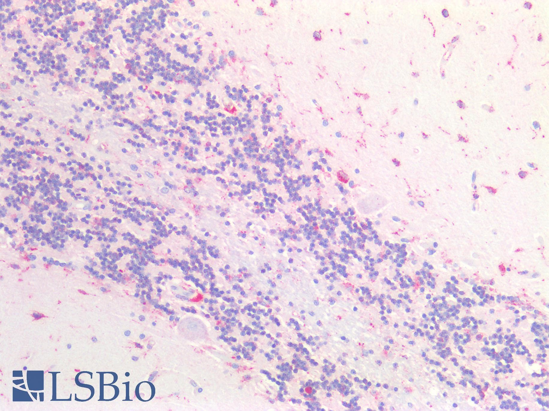 IHC-plus™ CTSB / Cathepsin B Antibody