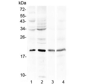 MB / Myoglobin Antibody