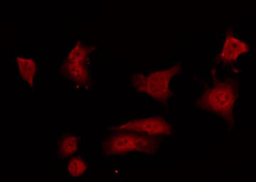 ARHGAP35 / GRLF1 Antibody (phospho-Tyr1105)