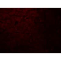 IHC-plus™ SLC29A2 / ENT2 Antibody