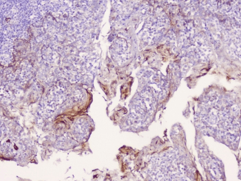 CD1B Antibody