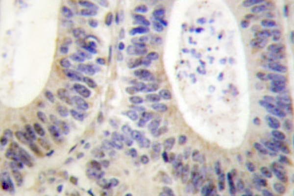 NCF1 / p47phox / p47 phox Antibody (Pro300)