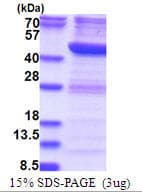 Human RTCD1 / RPC Protein (Recombinant His)