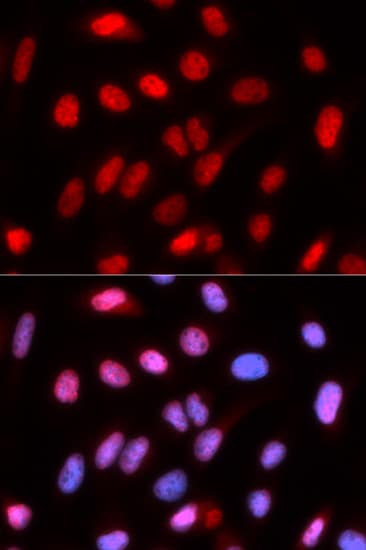 Polyclonal Rabbit anti-Human RFC4 Antibody (IHC, IF, WB)