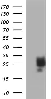 KITLG / SCF Antibody (clone OTI5F6)