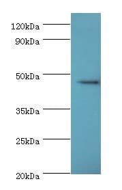 STK32A Antibody (aa1-166)